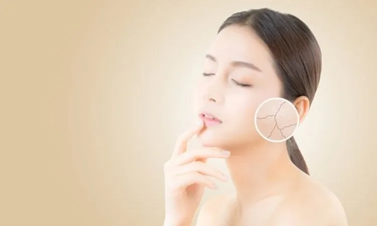 Xá xị hỗ trợ cải thiện làn da và chống lão hóa